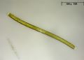 Nitzschia sigmoide