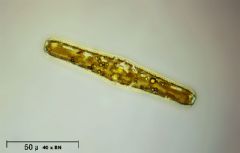 Rhopalodiales