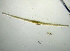 Toxariales
