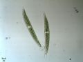 Closterium sp.