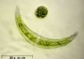 Closterium leibleinii