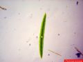 Closterium acerosum