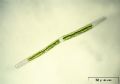 Closterium angustatum