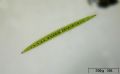 Closterium acerosum