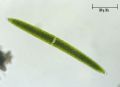 Closterium lunula