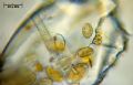 Cocconeis sp.