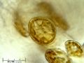Cocconeis sp.