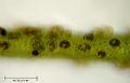 Cocconeis sp.