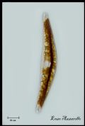 Cymbella lanceolata