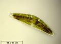 Cymbella gastroides