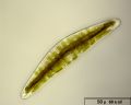 Cymbella gastroides