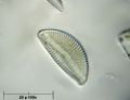 Encyonema caespitosum