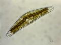 Cymbella sp.