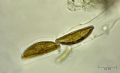 Encyonema sp.
