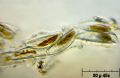 Encyonema prostratum