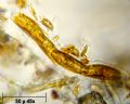 Encyonema prostratum