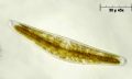 cymbella gastroides