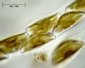 Encyonema prostratum