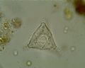 Staurastrum manfeldtii