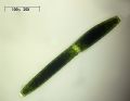 Pleurotaenium trabecula