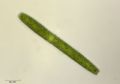 Pleurotaenium trabecula