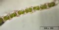 Hyalotheca sp.