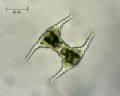 Staurastrum gracile