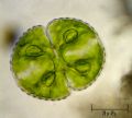 Cosmarium tetraophtalmum
