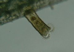 Flosculariidae