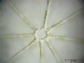 Asterionella formosa