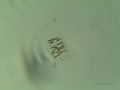 Fragilaria sp.
