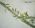Synedra sp.