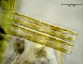 Diatoma sp.