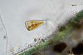 Gomphonema sp.