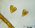 Gomphonema sp.