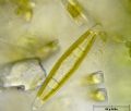 Navicula sp.