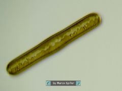 Pinnulariaceae