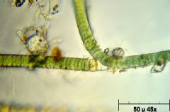 Microchaetaceae