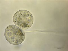 Peritrichida