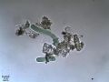 Oscillatoria sp.