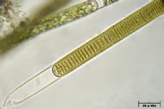 Phormidiaceae