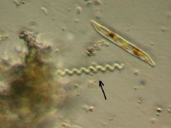 Pseudanabaenaceae