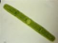 Penium sp.