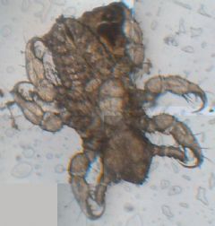 Pediculidae