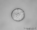 Cyclotella sp.