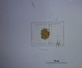 Striatella sp.
