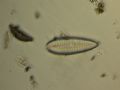 Surirella sp.