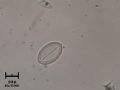 Surirella sp.