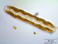 Cymatopleura solea