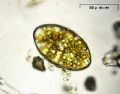 Cymatopleura elliptica